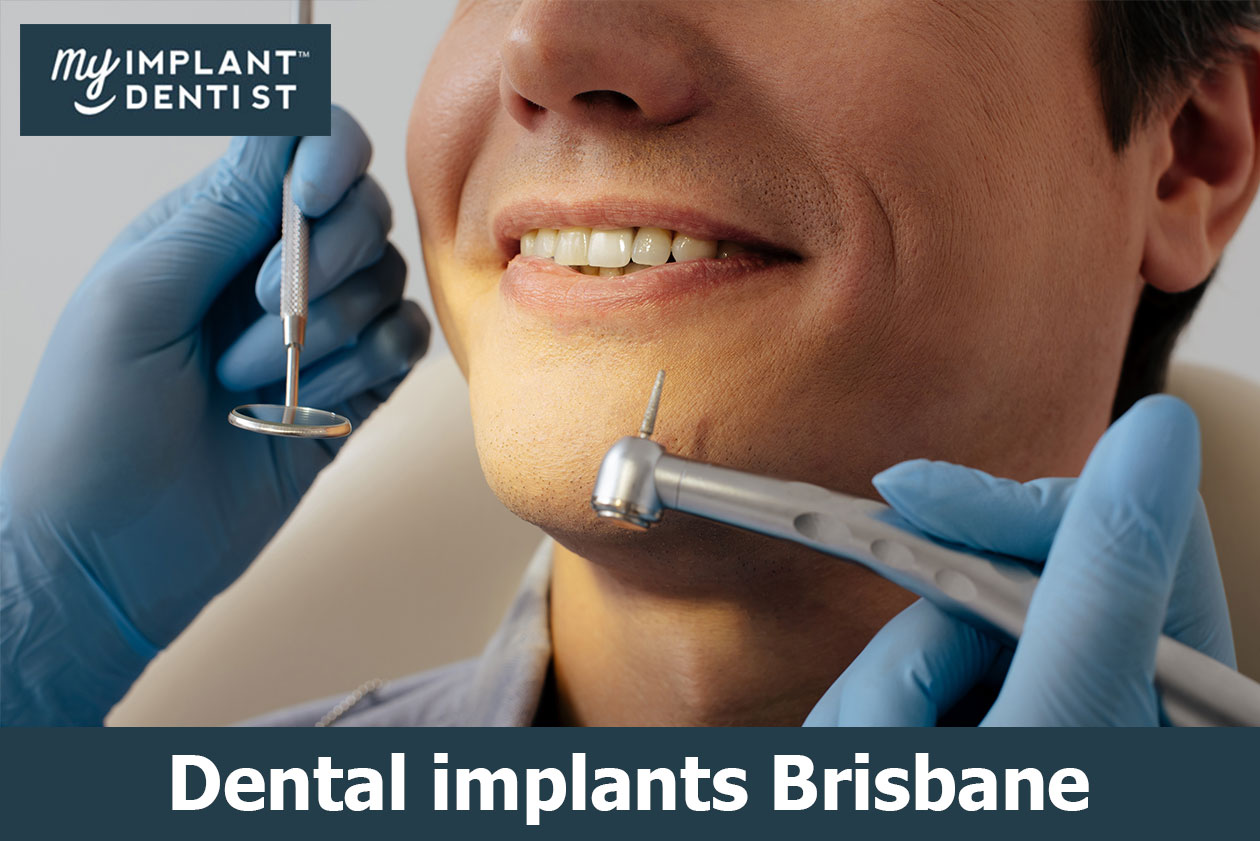 Dental Implants Are  Generally Made Of Titanium  As Well As Are Placed Into The Jawbone